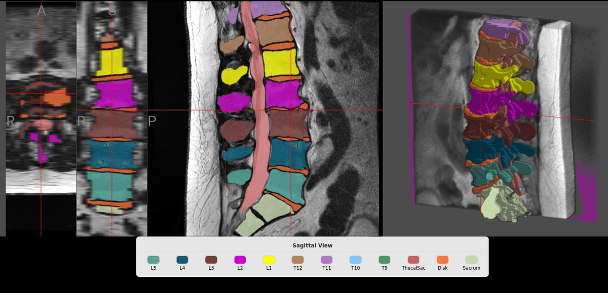 MRI Analysis Interface